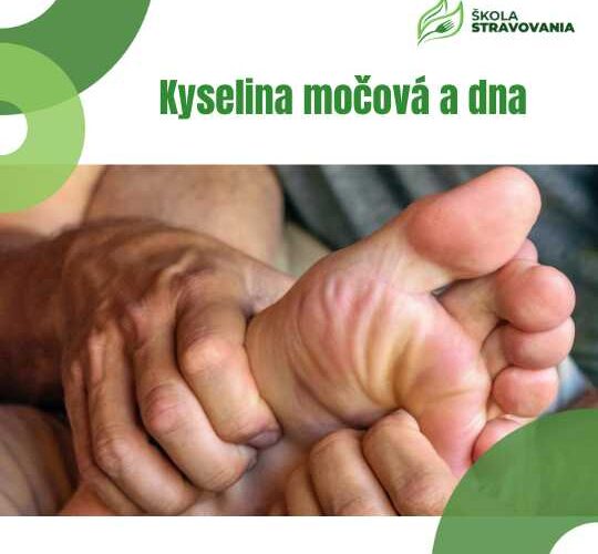 Kyselina močová a dna